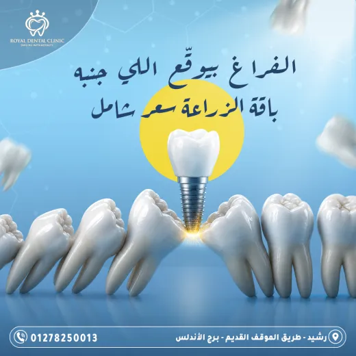 عيادات رويال ل طب الاسنان
