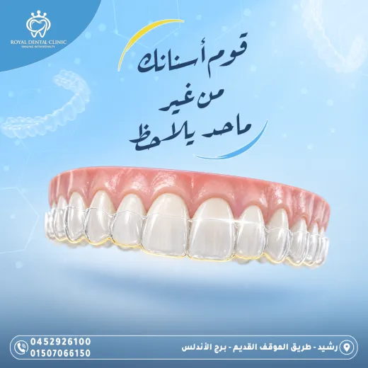 عيادات رويال ل طب الاسنان