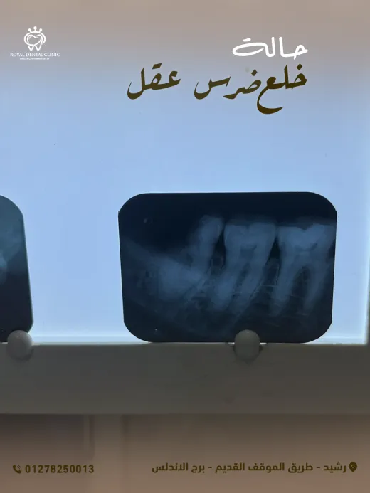 ROYAL Dental Clinic