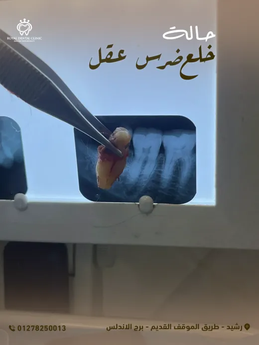 ROYAL Dental Clinic